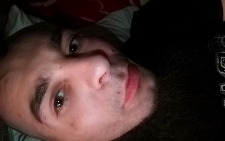 Zbiórka zbiorka na powazna operacje guza - zdjęcie główne