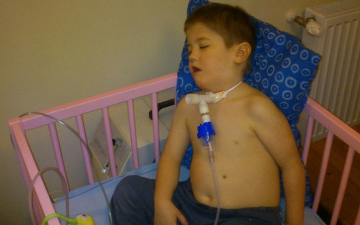 Chłopiec śpiący w łóżku, z rurką do oddychania.