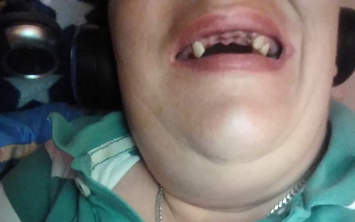 Zbiórka Na protezę zębową - zdjęcie główne