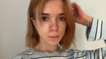 Zbiórka Leczenie anoreksji i depresji - miniaturka zdjęcia