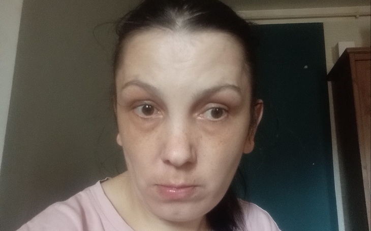 Zbiórka Na leczenie i życia codzienne - zdjęcie główne