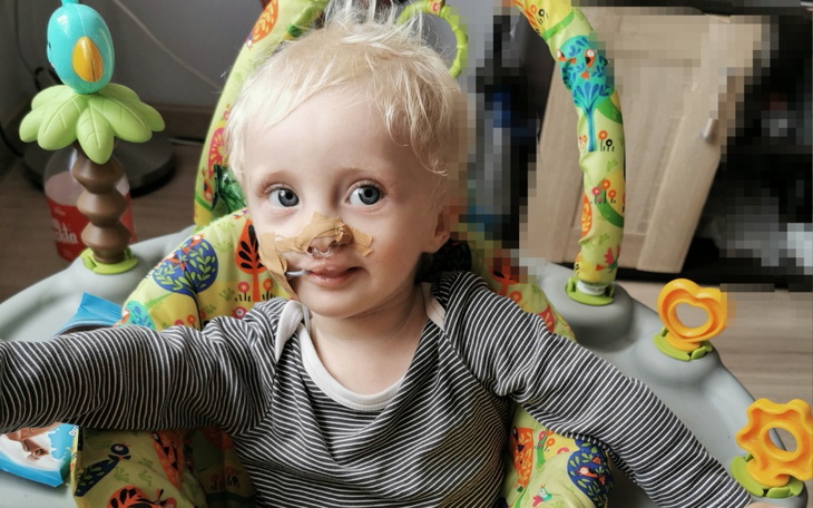 Małe dziecko z uśmiechem i opatrunkiem na nosie.