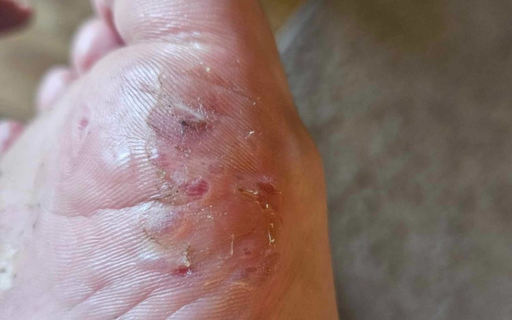 Zbiórka Leczenie chorego dziecka prośba - zdjęcie główne