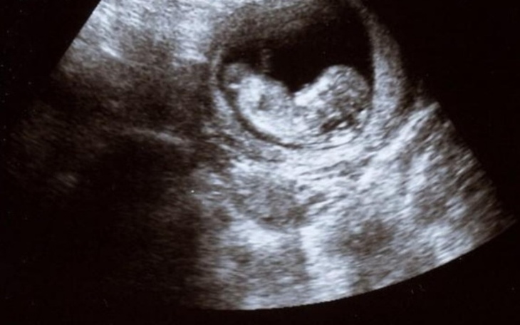 Zbiórka Koszty leczenia niepłodności - zdjęcie główne