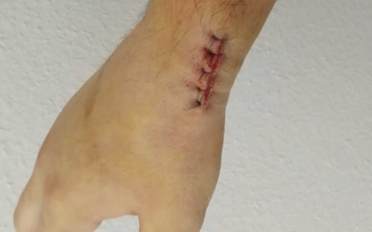 Zbiórka Kredyt2 - zdjęcie główne