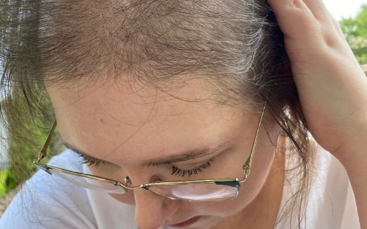 Zbiórka Pomóż mi poczuć się znów Kobietą - zdjęcie główne