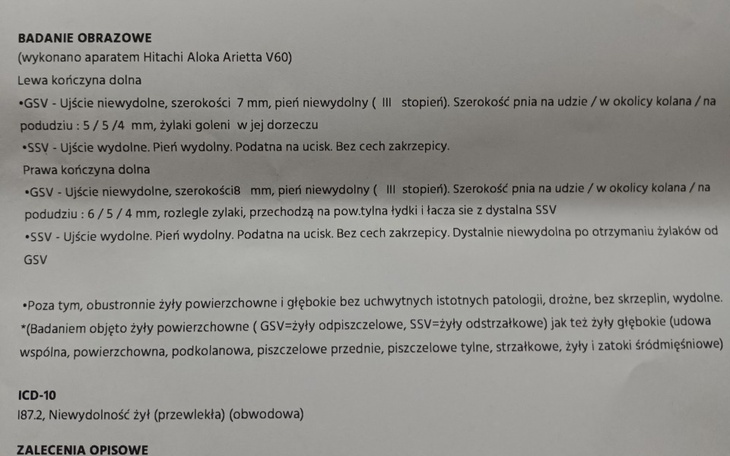 Zbiórka Na laserowe usuwanie żylaków . - zdjęcie główne