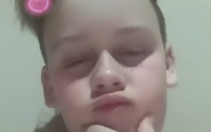 Zbiórka Na operację dla Gryzla - zdjęcie główne