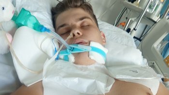 Zbiórka Na rehabilitacje dla KORNELA♥️ - miniaturka zdjęcia