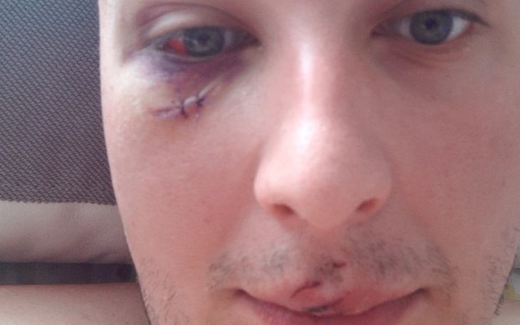 Zbiórka Zbieram na powrót do zdrowia po - zdjęcie główne