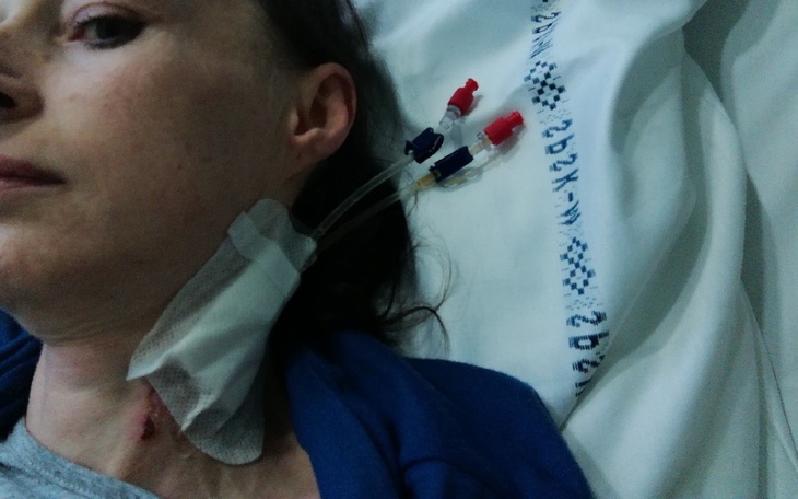 Zbiórka Po dwóch przeszczepach chce żyć - zdjęcie główne