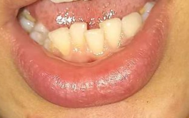 Zbiórka Szansa na ładny uśmiech aparat - zdjęcie główne