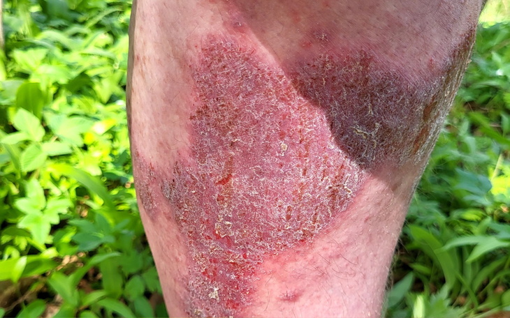 Skóra z widocznymi zmianami, prawdopodobnie chorobowymi.