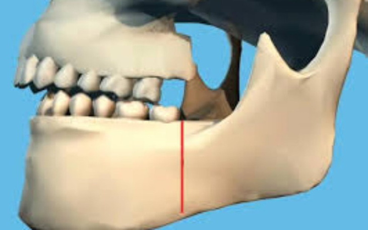 Zbiórka operacja retrogenia - zdjęcie główne