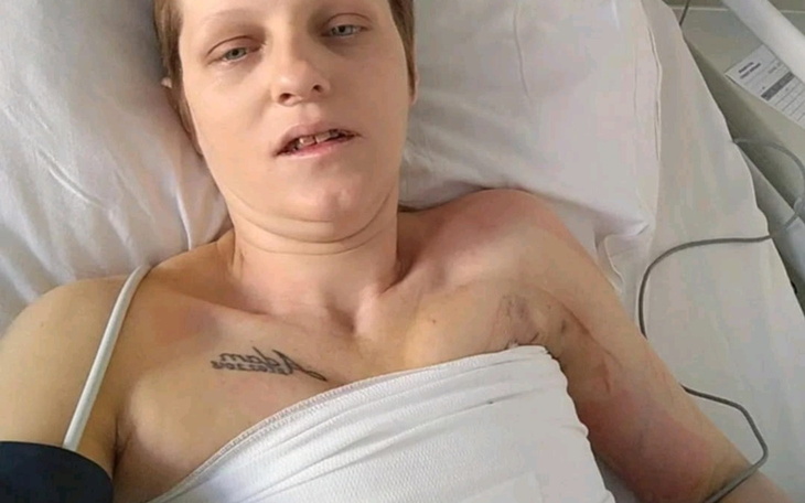 Kobieta leżąca w szpitalnym łóżku, z widocznymi ranami.