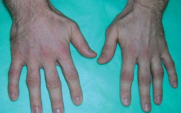 Zbiórka Leczenie biologiczne 1 - zdjęcie główne