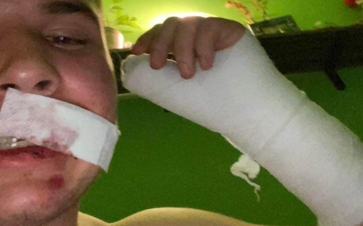 Zbiórka Pomoc w leczeniu po pobiciu - zdjęcie główne