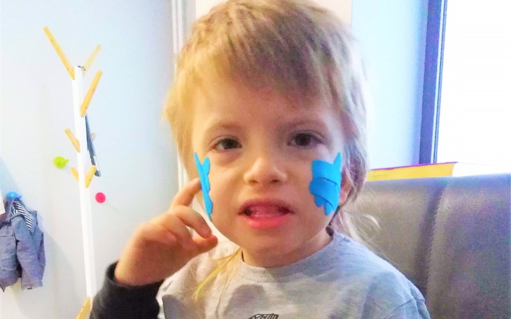 Chłopiec z niebieskimi naklejkami na twarzy, uśmiechnięty.