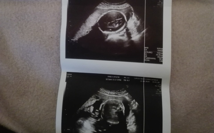 Zbiórka Czekamy na dziecko - zdjęcie główne