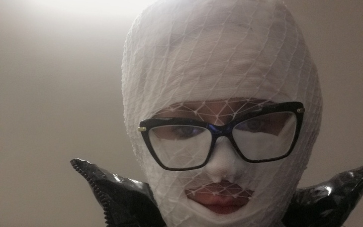 Zbiórka Rehabilitacja Dla Iwci - zdjęcie główne