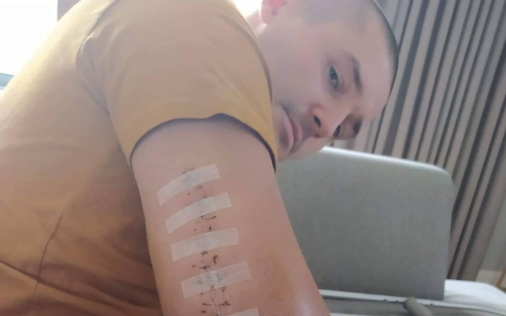 Zbiórka Na operację ręki Rafała - zdjęcie główne