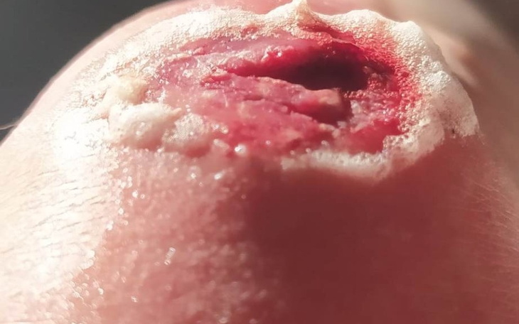 Zbiórka Odszkodowanie za błąd medyczny - zdjęcie główne