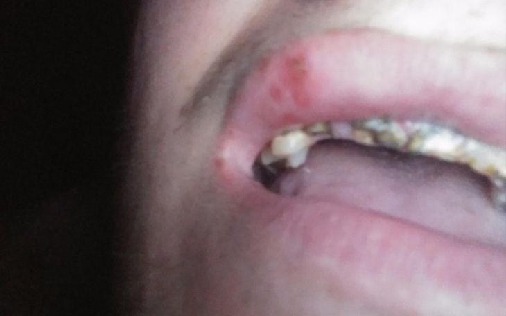 Zbiórka Na leczenie stomatologicznee - zdjęcie główne