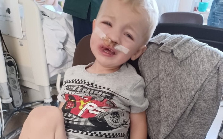 Chłopiec z opatrunkiem na twarzy, siedzący w szpitalu.