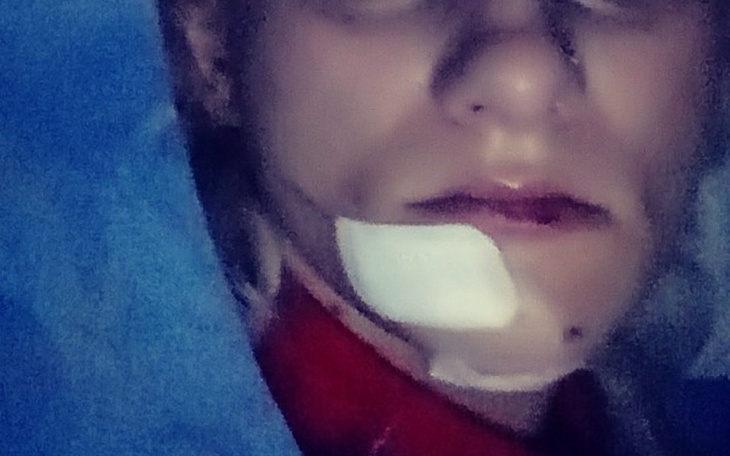 Zbiórka " nowa twarz " - zdjęcie główne