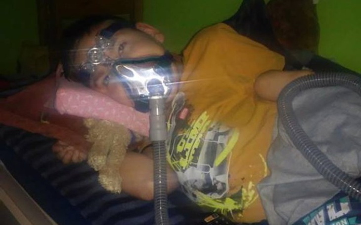 Chłopiec z maską tlenową leży na łóżku.