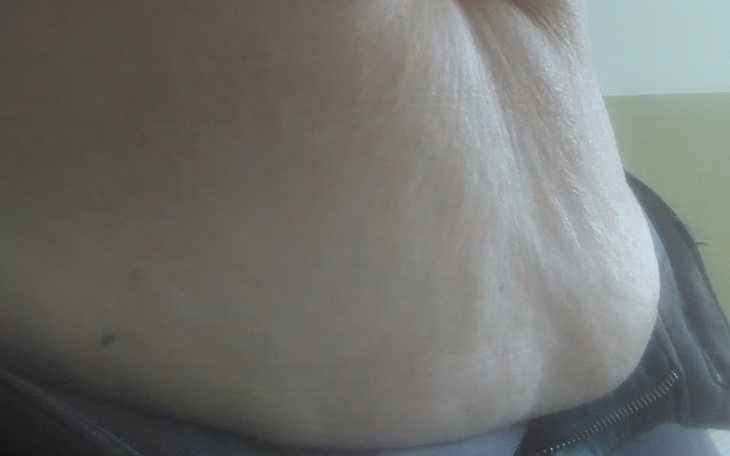 Zbiórka Pozbyć się go raz na zawsze... - zdjęcie główne