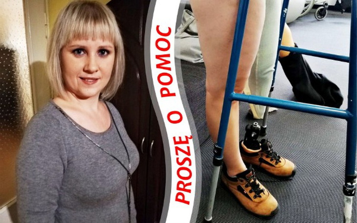 Zbiórka Potrzebuję nowej nogi - zdjęcie główne