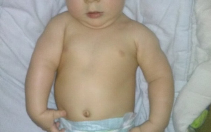 Zbiórka Operacja w Aachen - zdjęcie główne