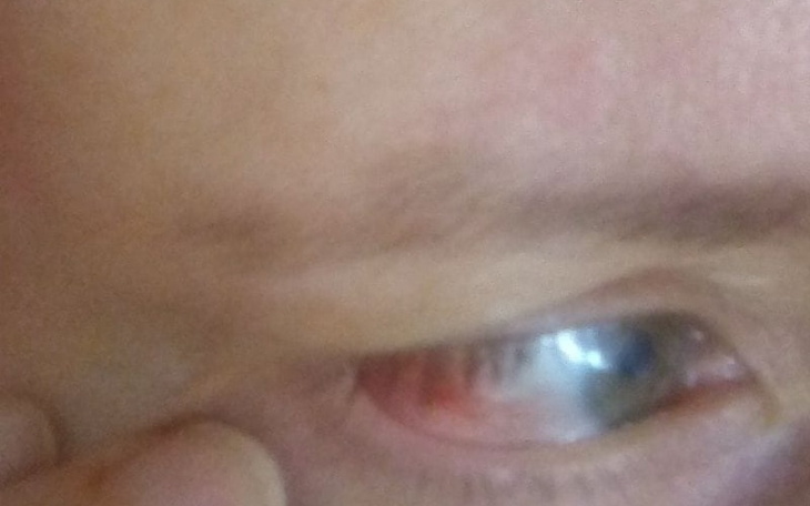 Zbiórka Leczenie wzroku Lepsze widzenie - zdjęcie główne