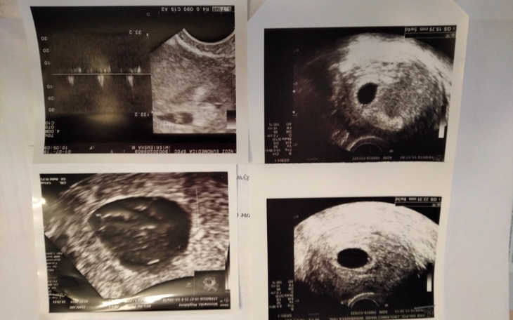Zbiórka In Vitro marzenie o potomstwie - zdjęcie główne