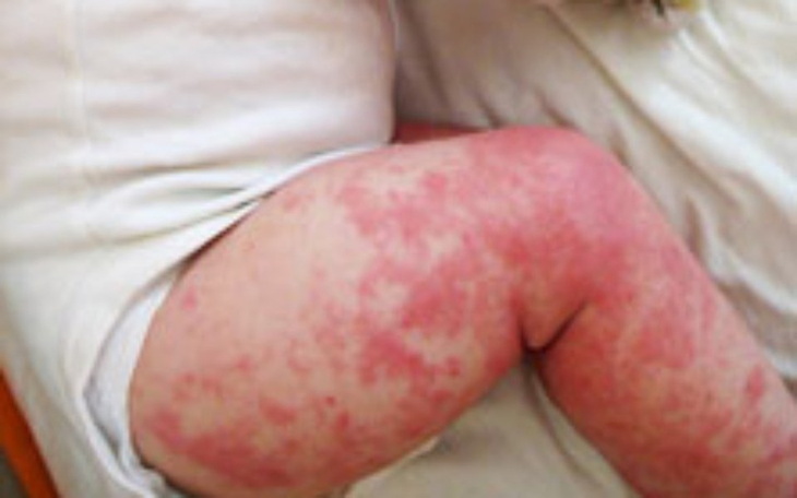 Zbiórka Beznadziejna sytuacja.... - zdjęcie główne