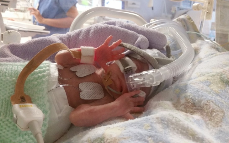 Zbiórka Święta autyzm - zdjęcie główne