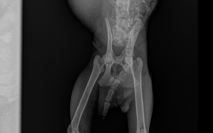 Zdjęcie rentgenowskie stawu, z widocznymi uszkodzeniami.
