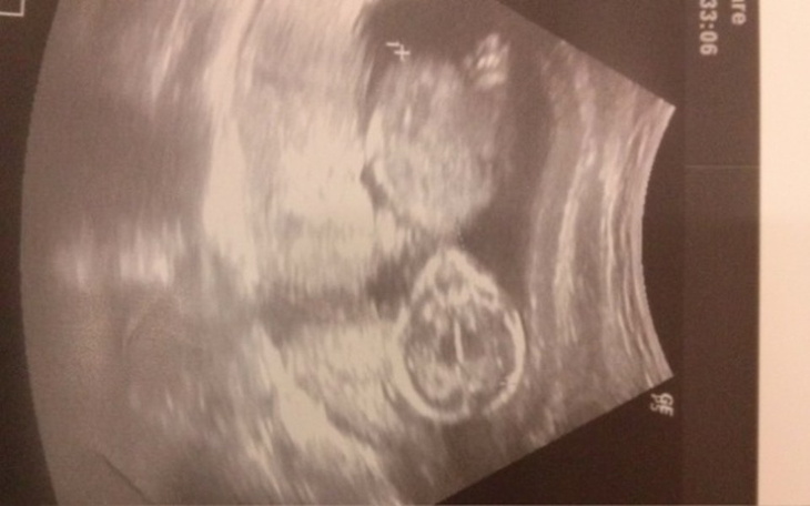 Zbiórka Pomozmy malej sunii. - zdjęcie główne