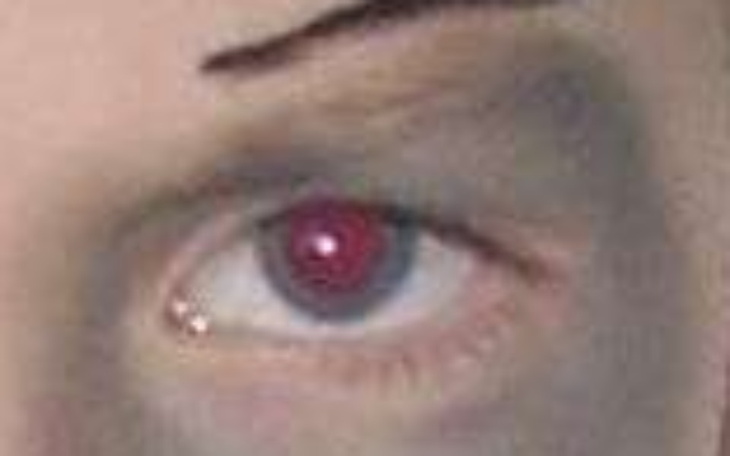 Zbiórka na operacje dla kuby - zdjęcie główne