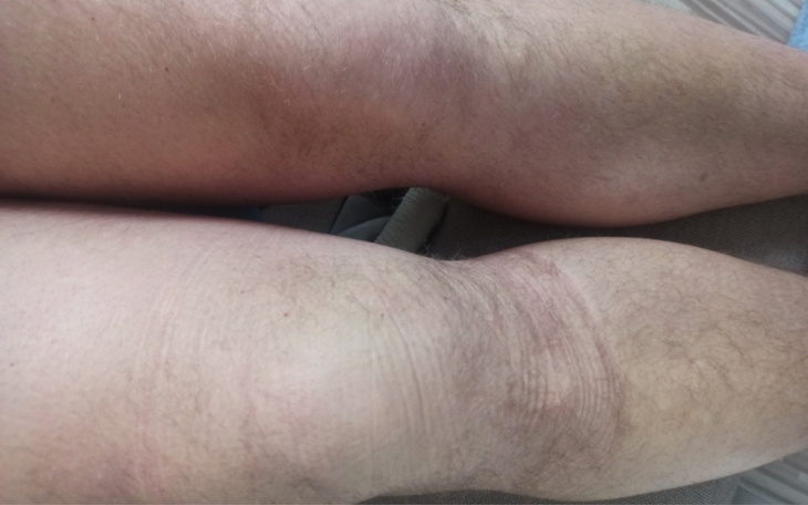 Zbiórka Na leczenie i utrzymanie rodziny - zdjęcie główne