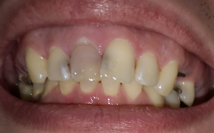 Zbiórka Poprawa uzębienia - zdjęcie główne