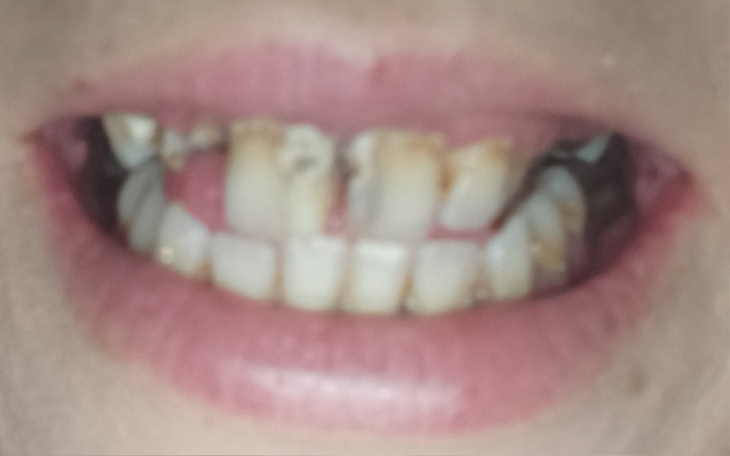 Zbiórka Na uśmiech którego mi brakuje - zdjęcie główne