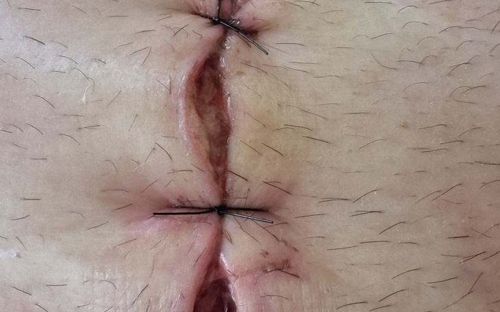 Zbiórka Na operacje i powrót do zdrowia - zdjęcie główne