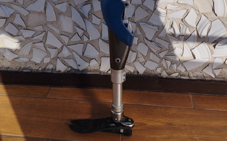 Zbiórka Na protezę lewej nogi dla Kazika - zdjęcie główne