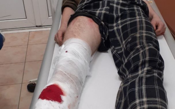 Zbiórka Zbiórka na Wózek po Wypadku - zdjęcie główne