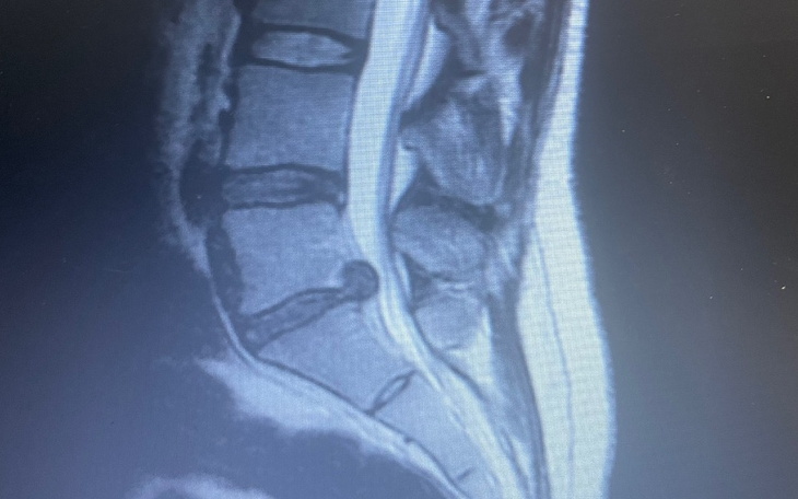 Zbiórka Na rehabilitacje i psychologa - zdjęcie główne