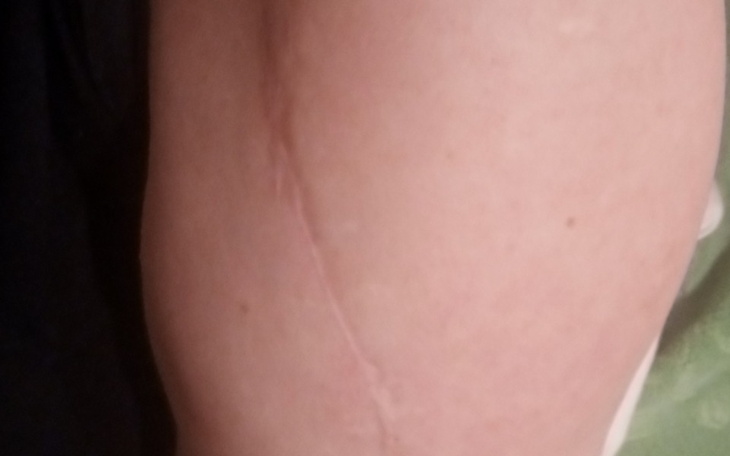 Zbiórka Operacja złamanej reki - zdjęcie główne