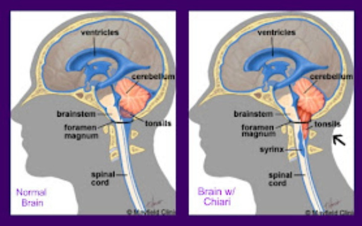 Zbiórka Leki i wizyty lekarskie - zdjęcie główne