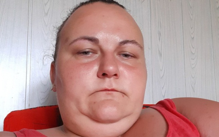 Zbiórka Pomóżcie normalnie  żyć - zdjęcie główne